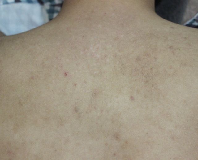 25세 남성 · 10개월 경과